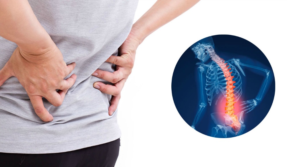 Osteoporoza: cauze, simptome si tratament | piese-dacia.ro